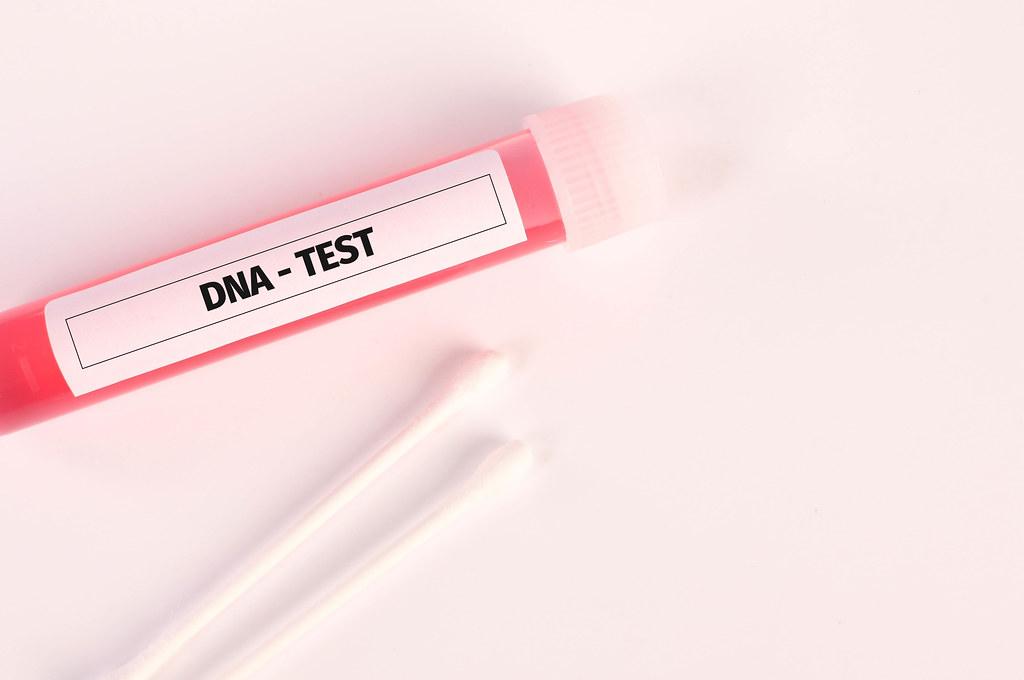 Hvilken DNA-test er best?